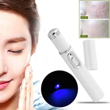 Load image into Gallery viewer, SKIN SPOTS REMOVAL LAZE PEN