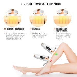 Silk Touch Pro™ IPL Hair Removal Device